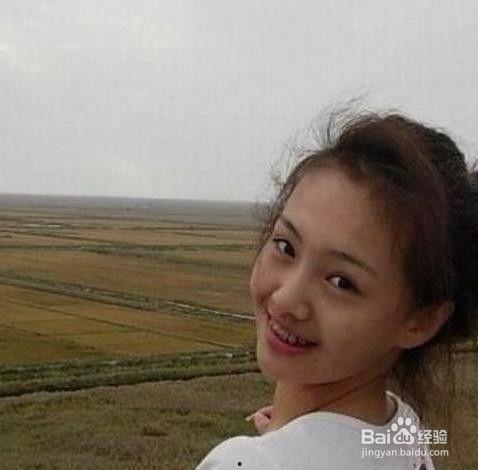 明星网红整牙,美丽蜕变之路